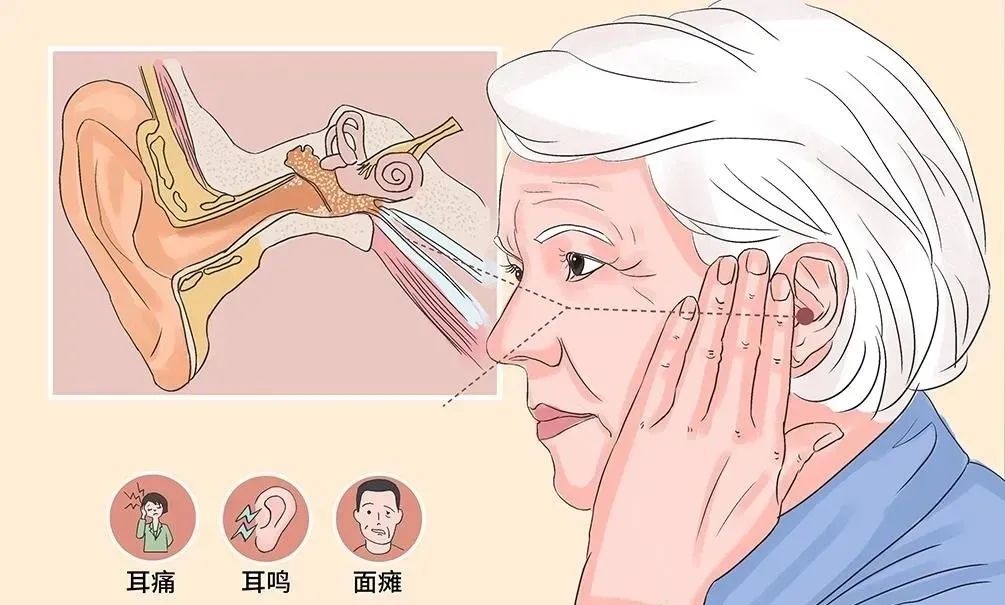 中耳炎怎么治?费用是多少?成都民生耳鼻喉医院答 国家三级医院