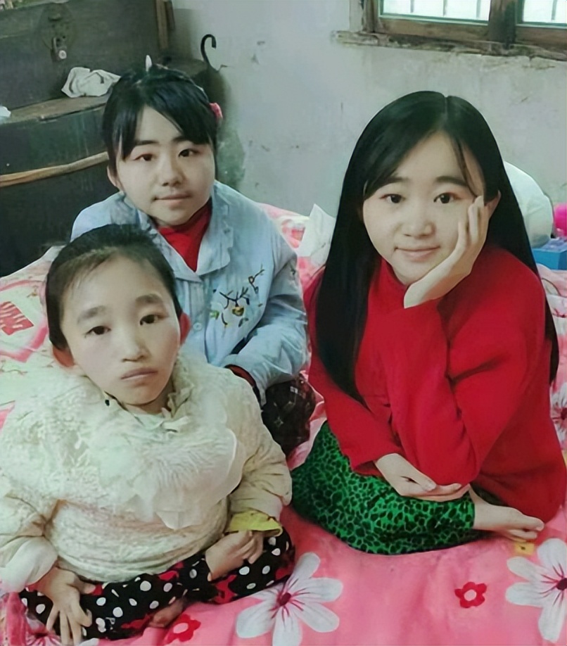 重庆女子连生三胎"瓷娃娃",却仍坚持生下第四胎,结局让人意外