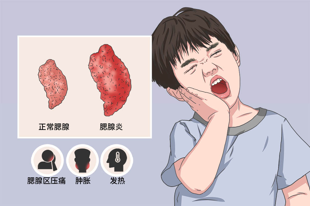 急性化脓性腮腺炎图片图片