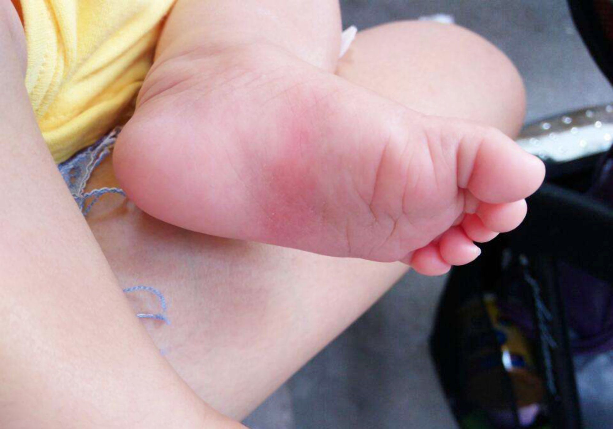 宝宝弓脚的照片图片