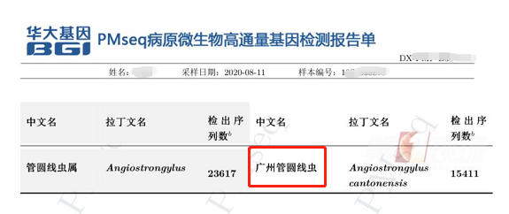 热点|深圳一小伙突然瘫坐路边，大小便失禁，原来是脑中布满虫子！