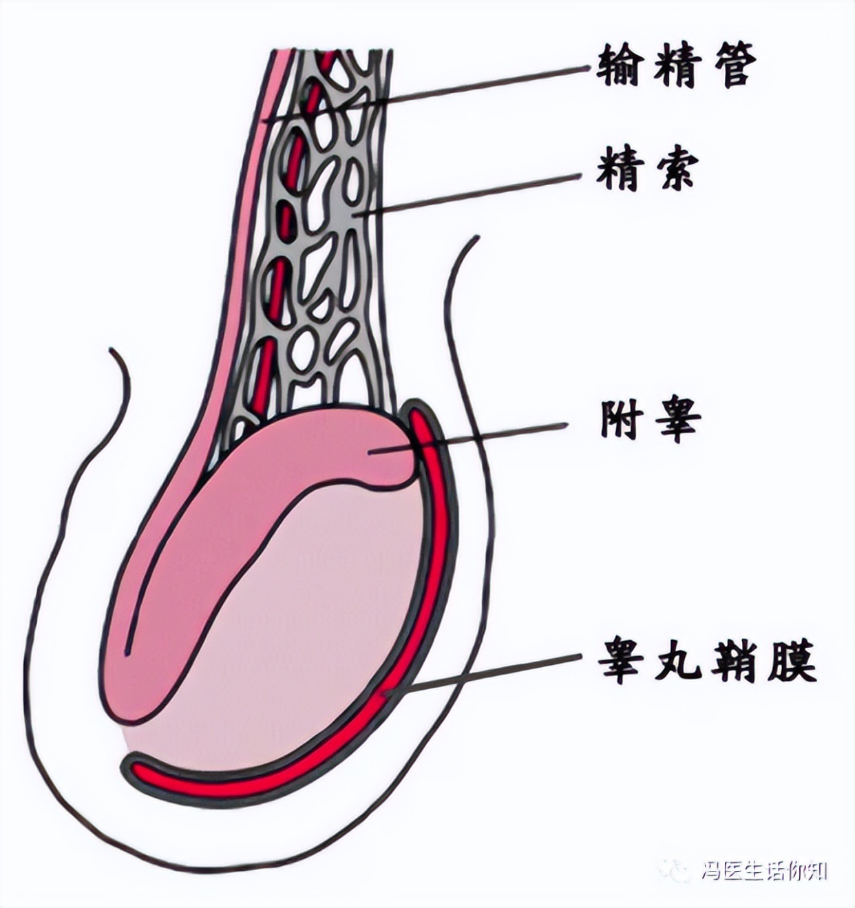 精索与疝囊的关系图图片