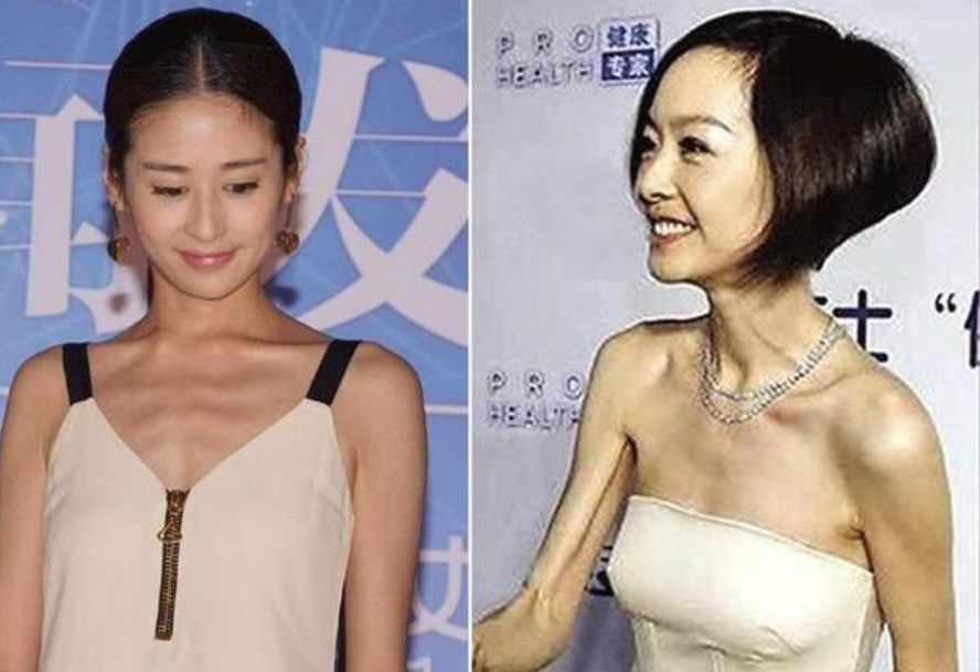 古人训:"瘦而露骨人多难,走步如雷命多舛",老祖宗的经验之谈