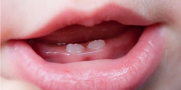 大概在宝宝半岁左右,会萌生小乳牙,出牙过程中,宝宝的牙床会感受到很