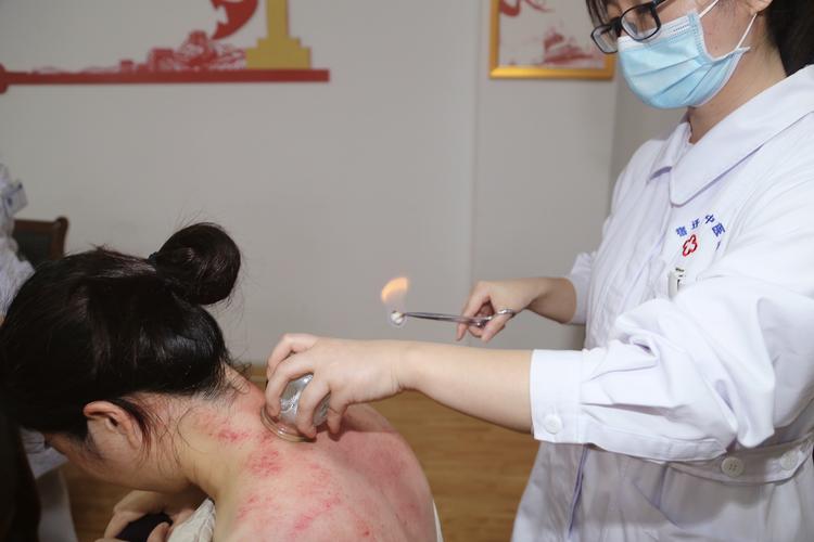 "拔罐"时,后背吸出的瘀血,真的是"毒素"吗?听听医生的说法