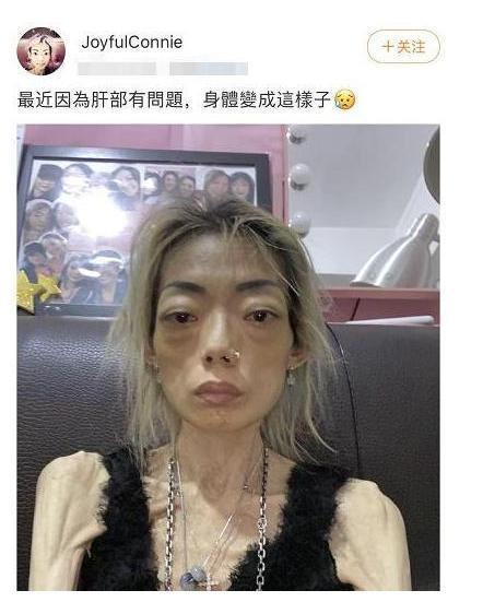 伍智恒22岁嫁入豪门,今生病只剩44斤