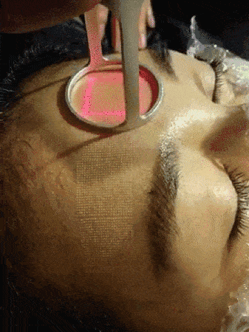 使co2激光能量渗透到肌肤下面并刺激新胶原蛋白生成,以分段形式应用