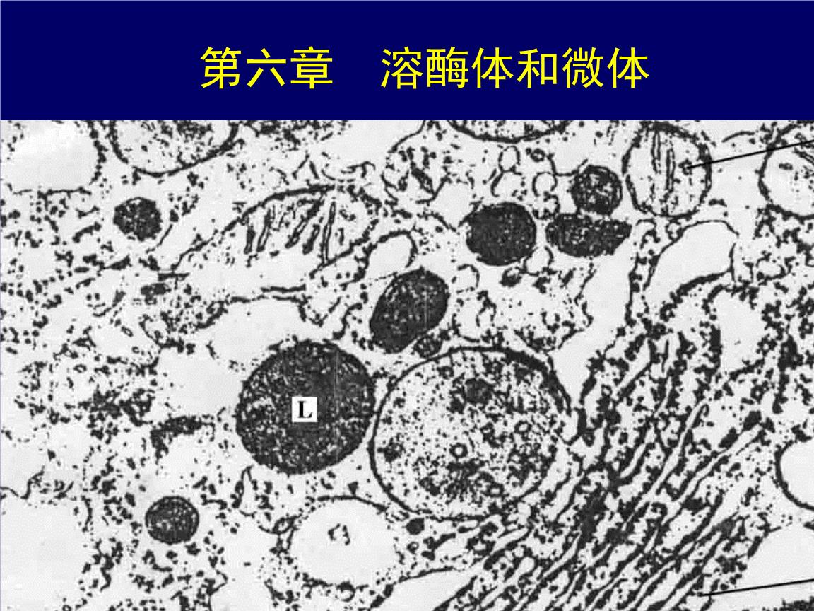 黏脂贮积症Ⅱ型,在出生时没有异常,症状有鼻涕增加,肝脏增大