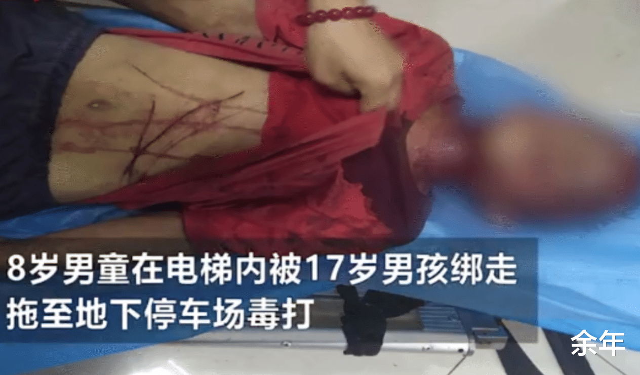 四川8岁男童被17岁男子绑走殴打,打人原因曝光,网友气炸了!