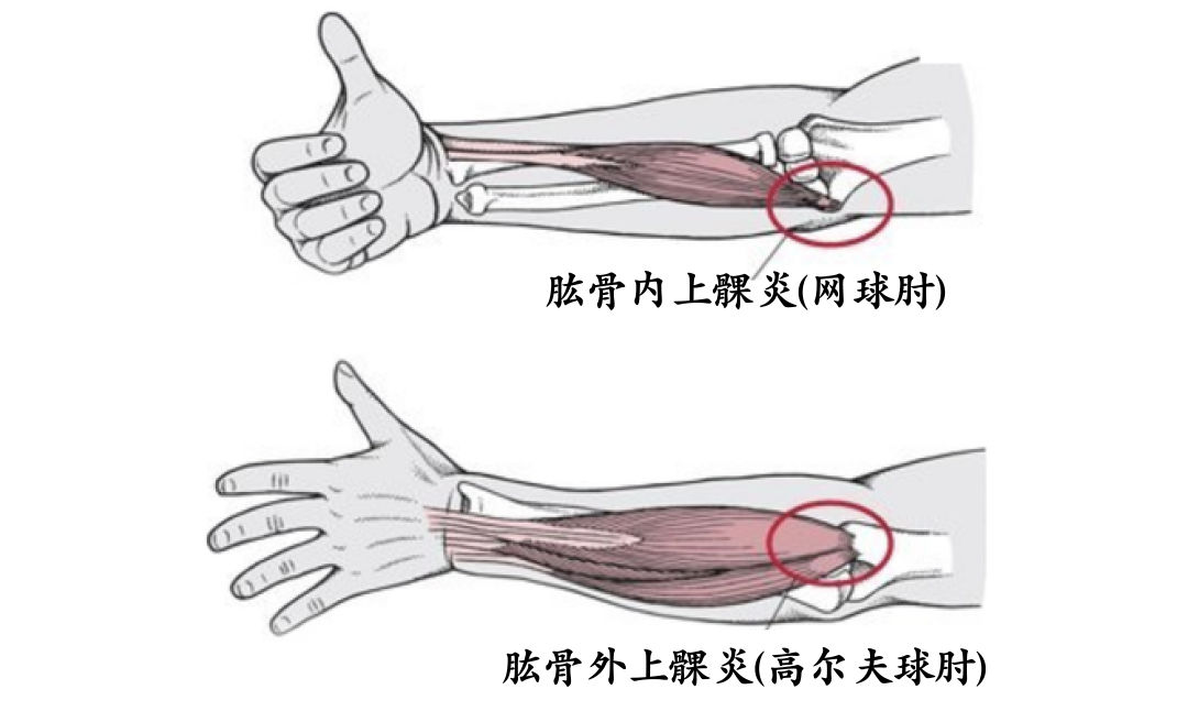 胳膊肘在哪个位置图片图片