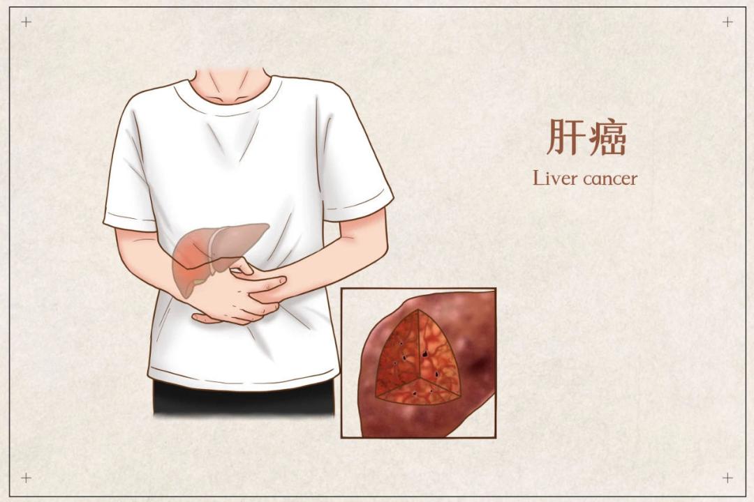 "肝不动了"不是一句玩笑话!因为