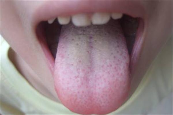 如果肝不好,牙齿可能会出现这3个现象,想养肝的平时或要注意了