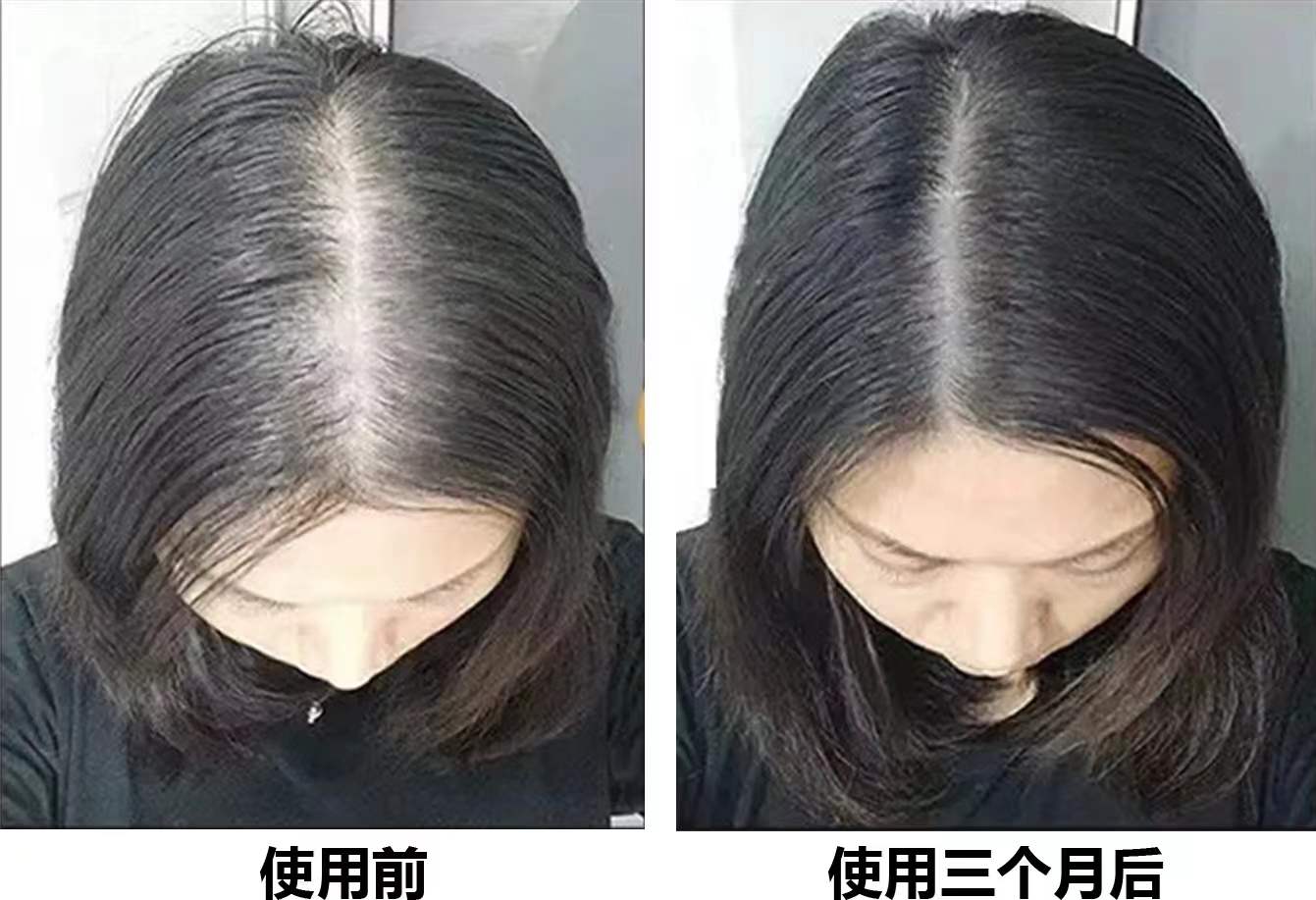 增發防脫髮的洗髮水生髮液哪種最好?男生女生如何快速長頭髮?