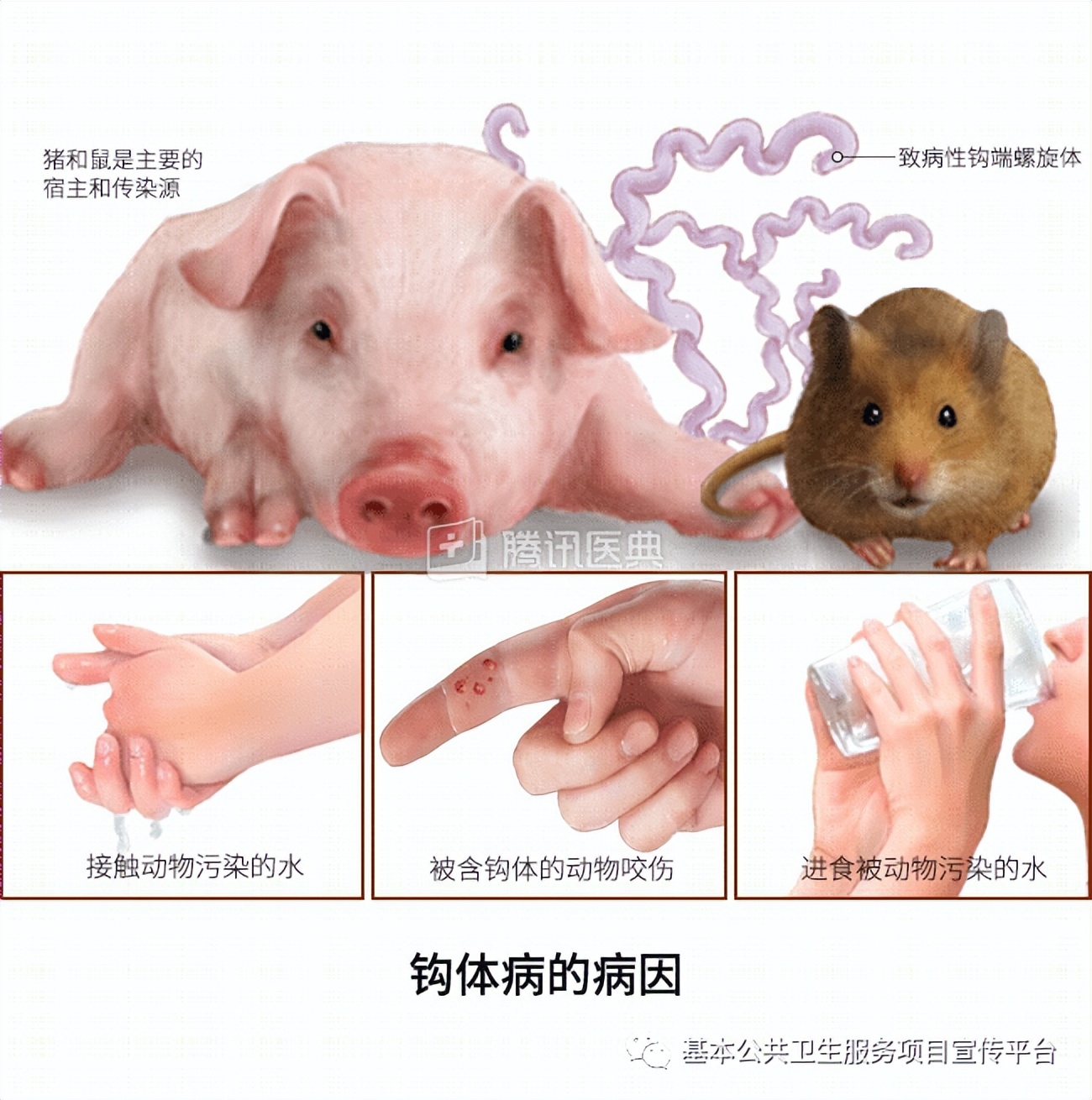 「传染病防治——钩端螺旋体病」至少225人死亡!