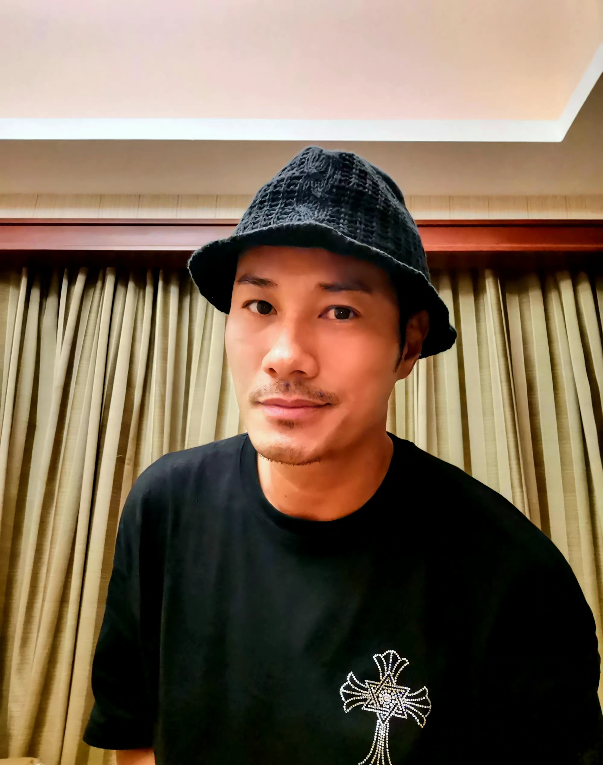 港星黄竣锋内地遇袭,被凶手拿菜刀连砍三刀,脸和手缝超过100针