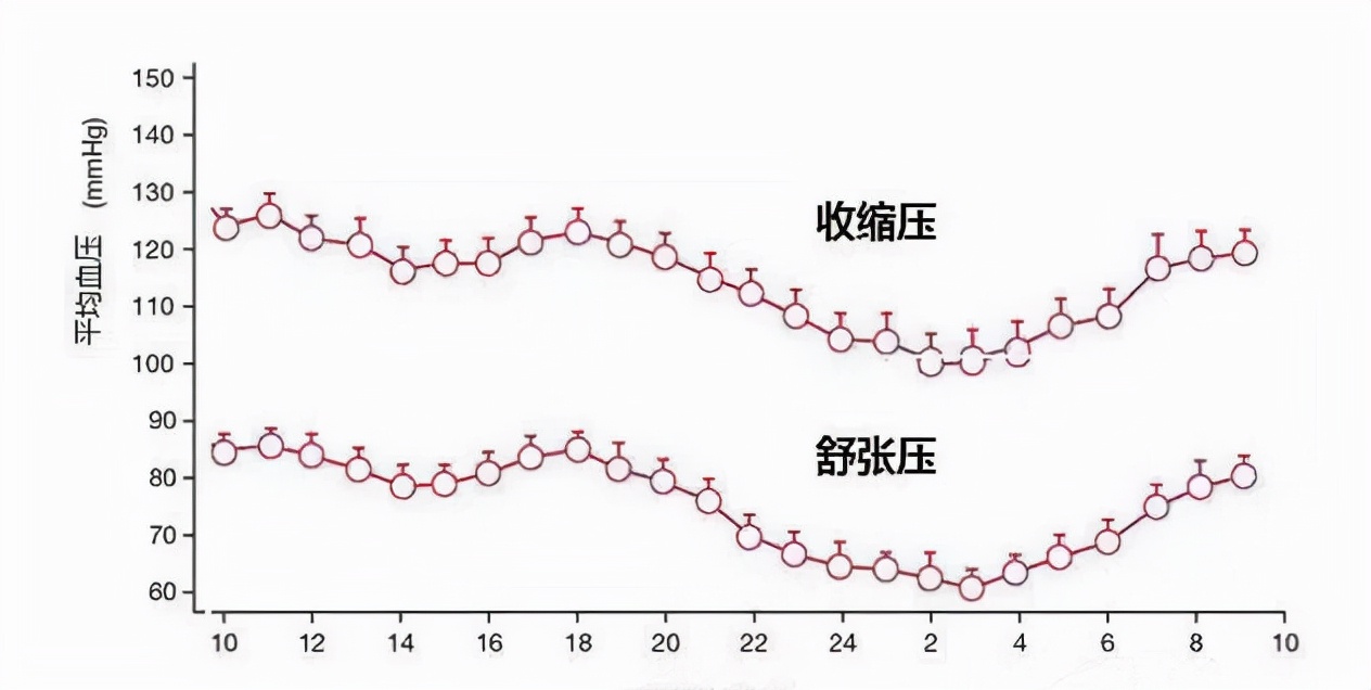 超勺型血压图片