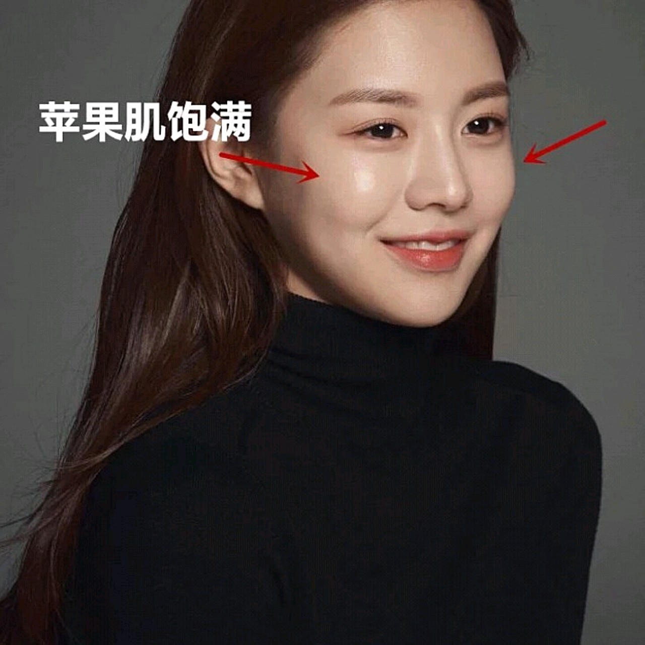 脸上有苹果肌漂亮吗?胶原蛋白填充苹果肌一些常见问题介绍