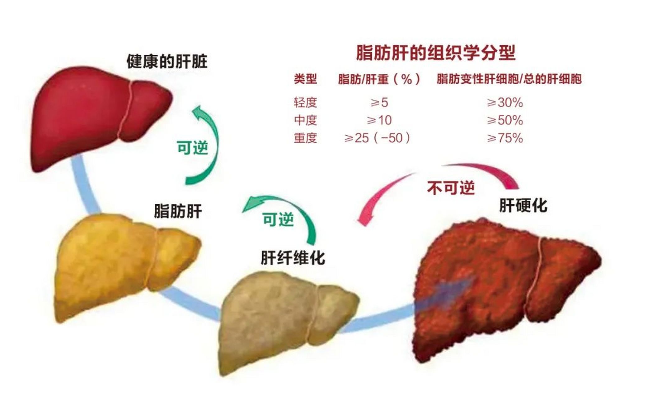 严重脂肪肝图片图片图片