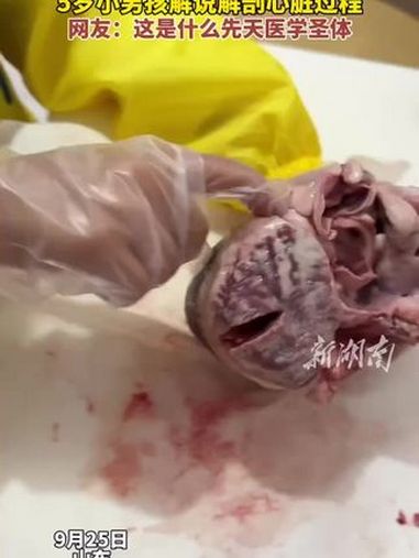 5岁小男孩解说解剖心脏过程.网友:这是什么先天医学圣体