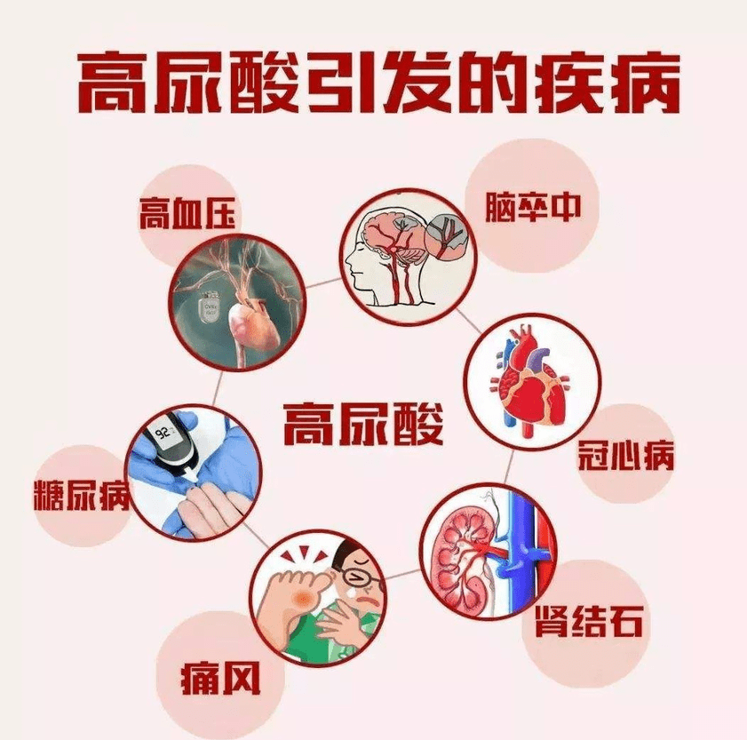 痛风患者降尿酸治疗就是要把尿酸降得越低越好吗?医生这样说