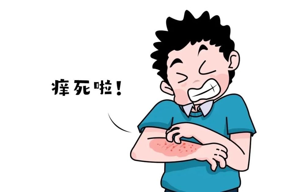 牛皮癣的初期症状有哪些?怎样正确诊断牛皮癣