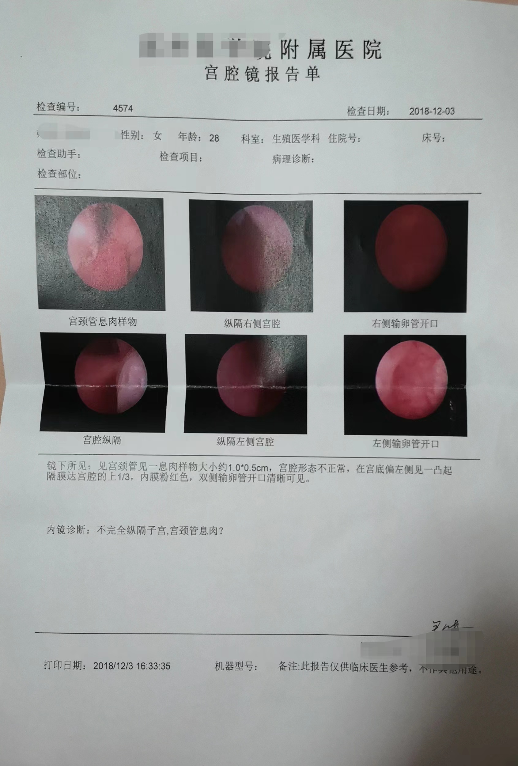 纵隔子宫怀孕图片图片