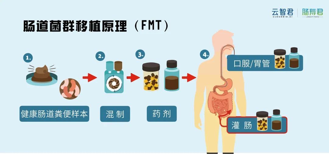 关于肠道菌群与菌群移植(fmt),你想知道的全在这里~