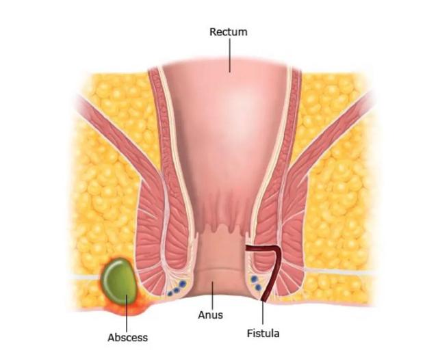 肛门是指哪里图片