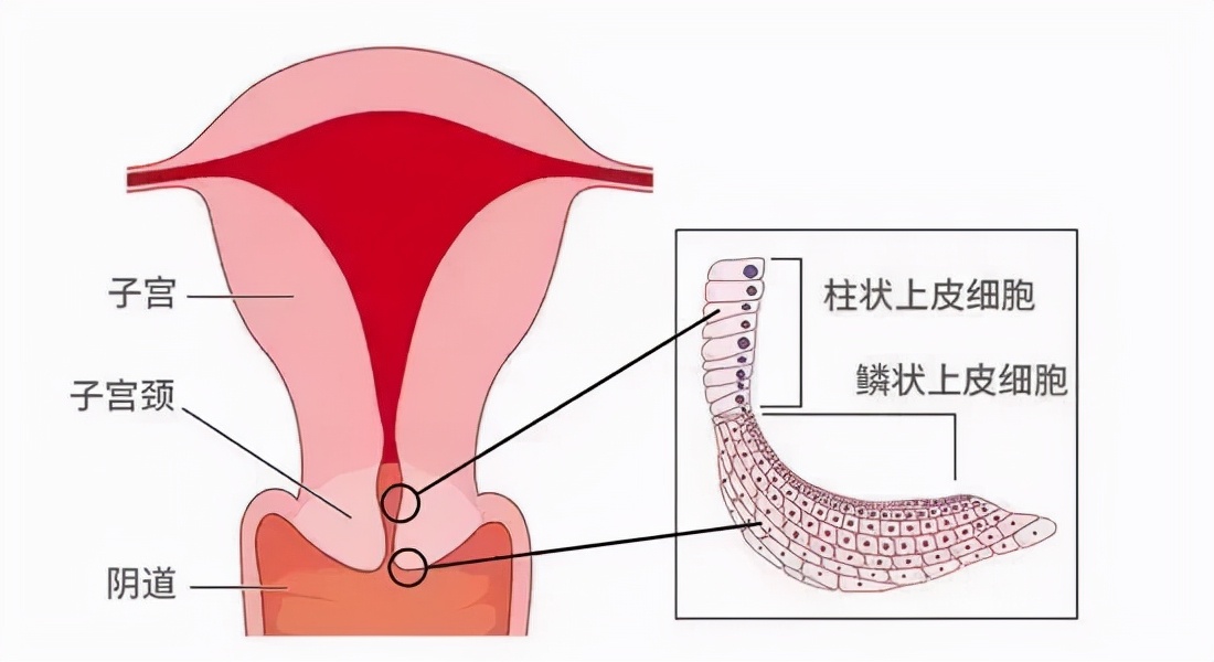 宫颈柱状细胞图片