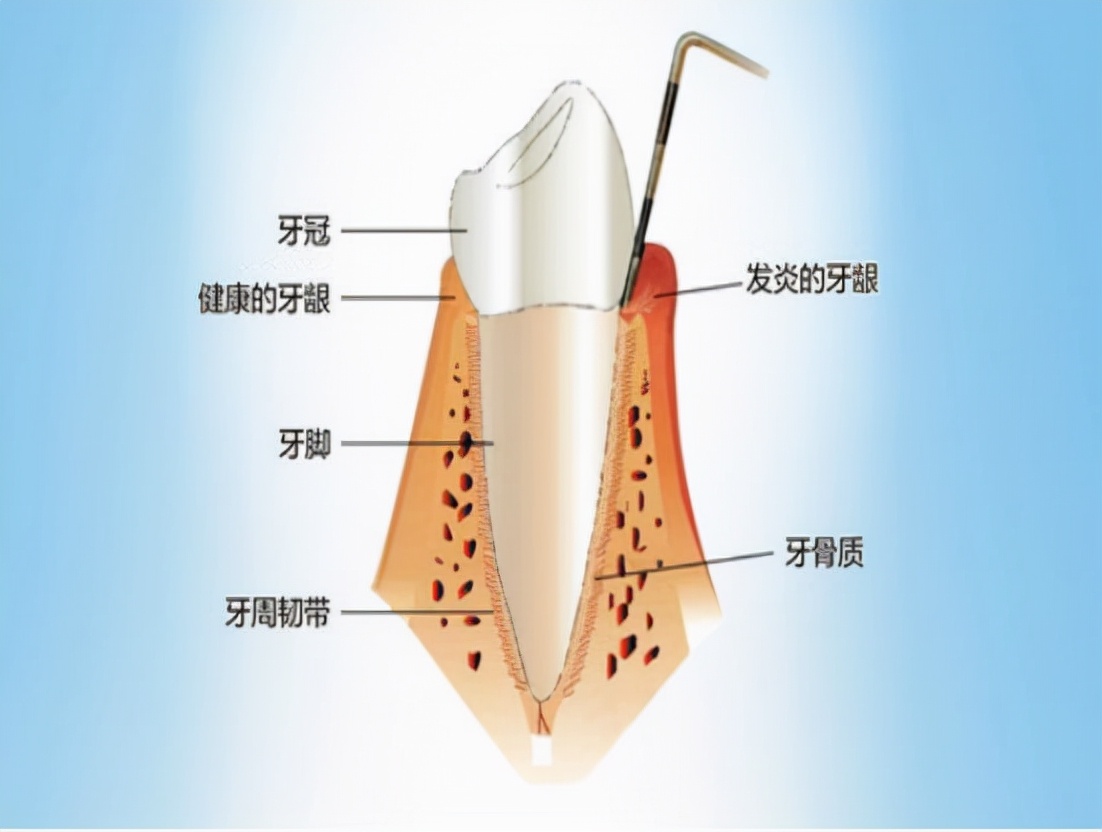 甲硝唑便宜又实用