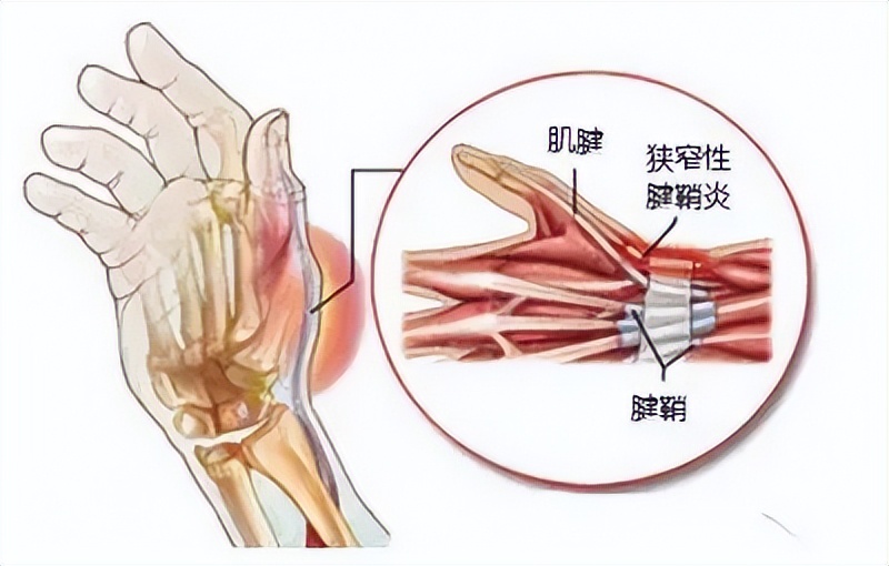 老年人手指僵硬,关节痛,正常吗?该如何缓解?一文详细告诉你