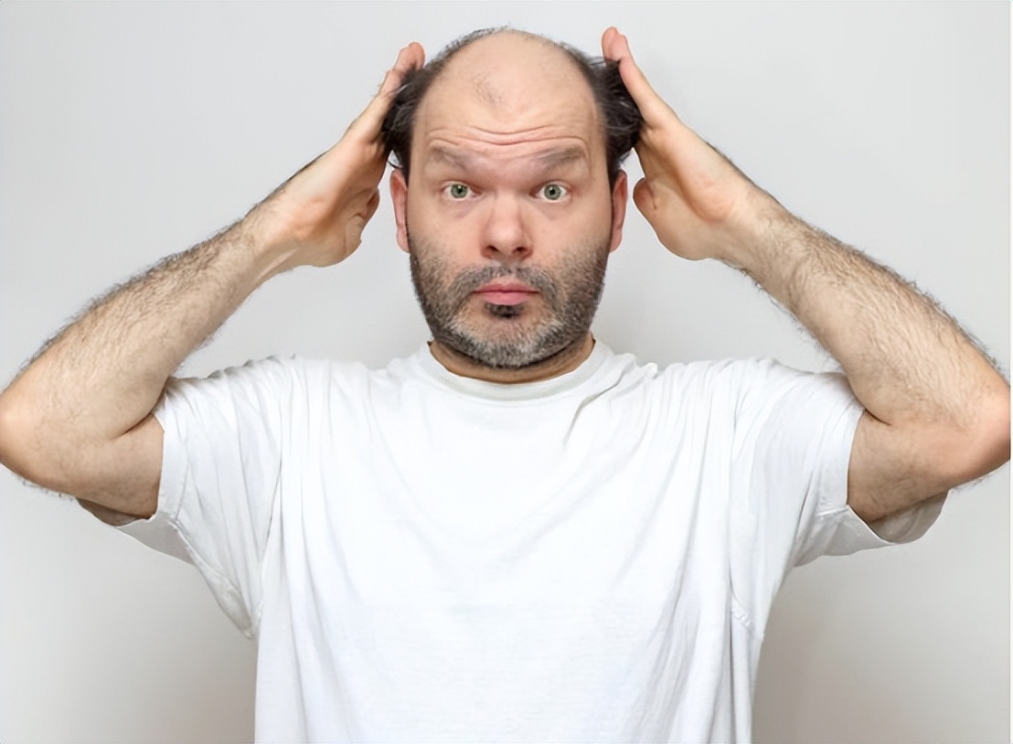 别人脱单你脱发!不想聪明"绝顶",治疗脱发最怕随大流的盲目