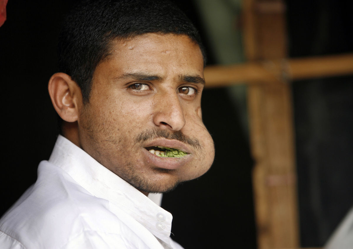 为什么老年痴呆患者越来越多?提醒:50岁后不妨记住3件事