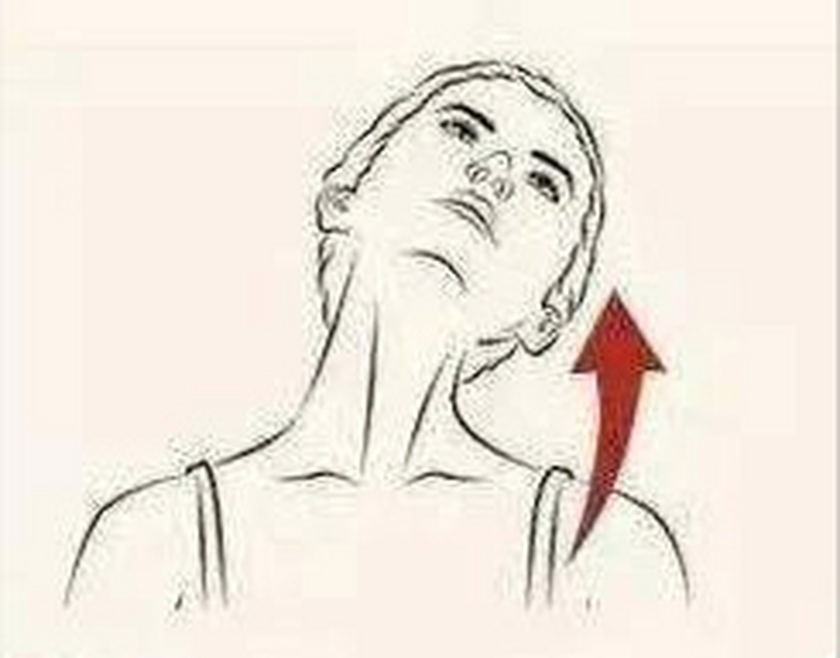 颈部肌肉痉挛图片