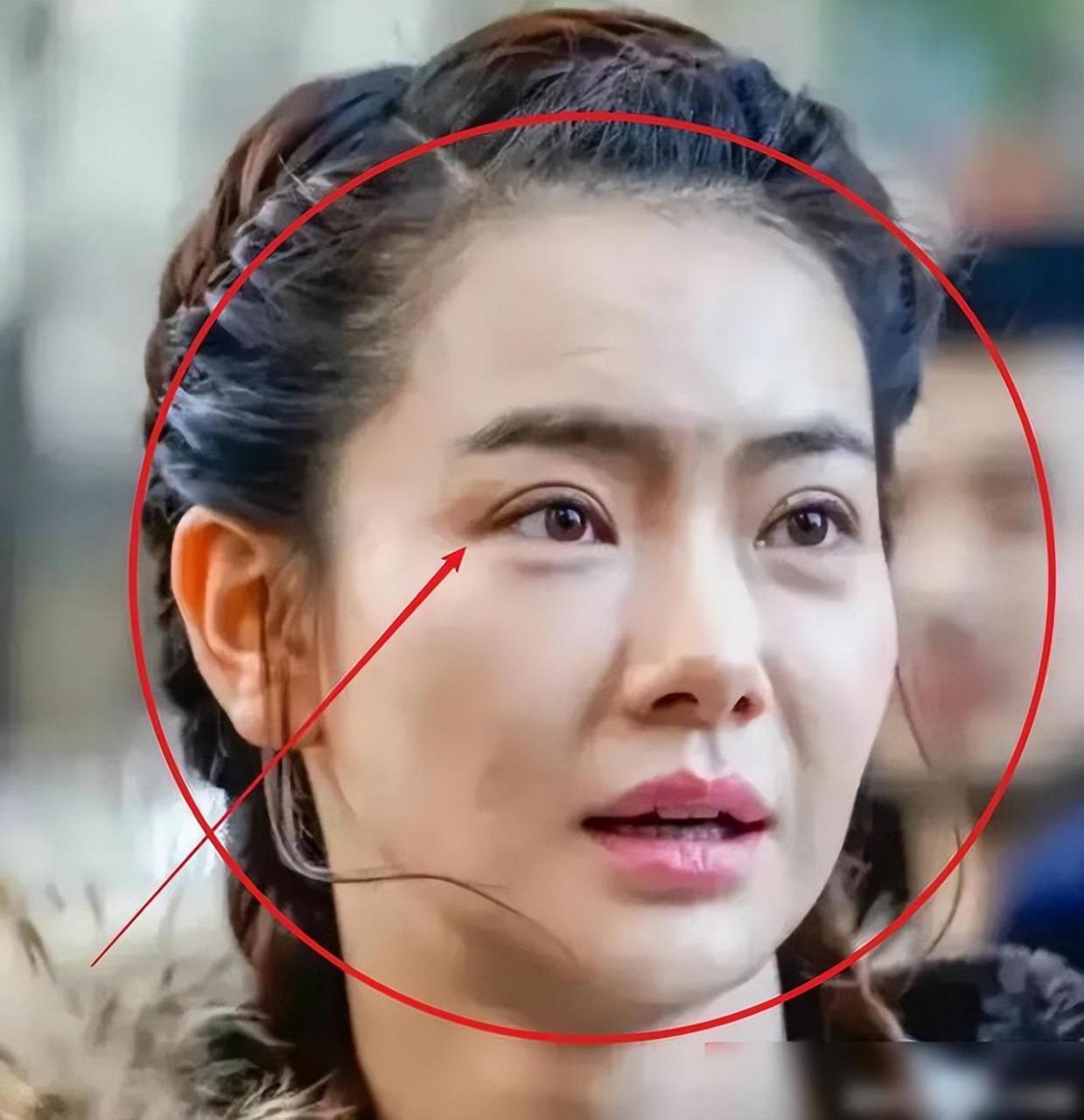 最令大众喜欢的就是戚薇,而且她的整容是众所周知的,戚薇自己也承认她