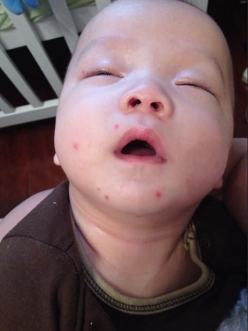 蚊子最大的"天敌"根本不是蚊香?教你个笨招:彻夜开窗也不用怕