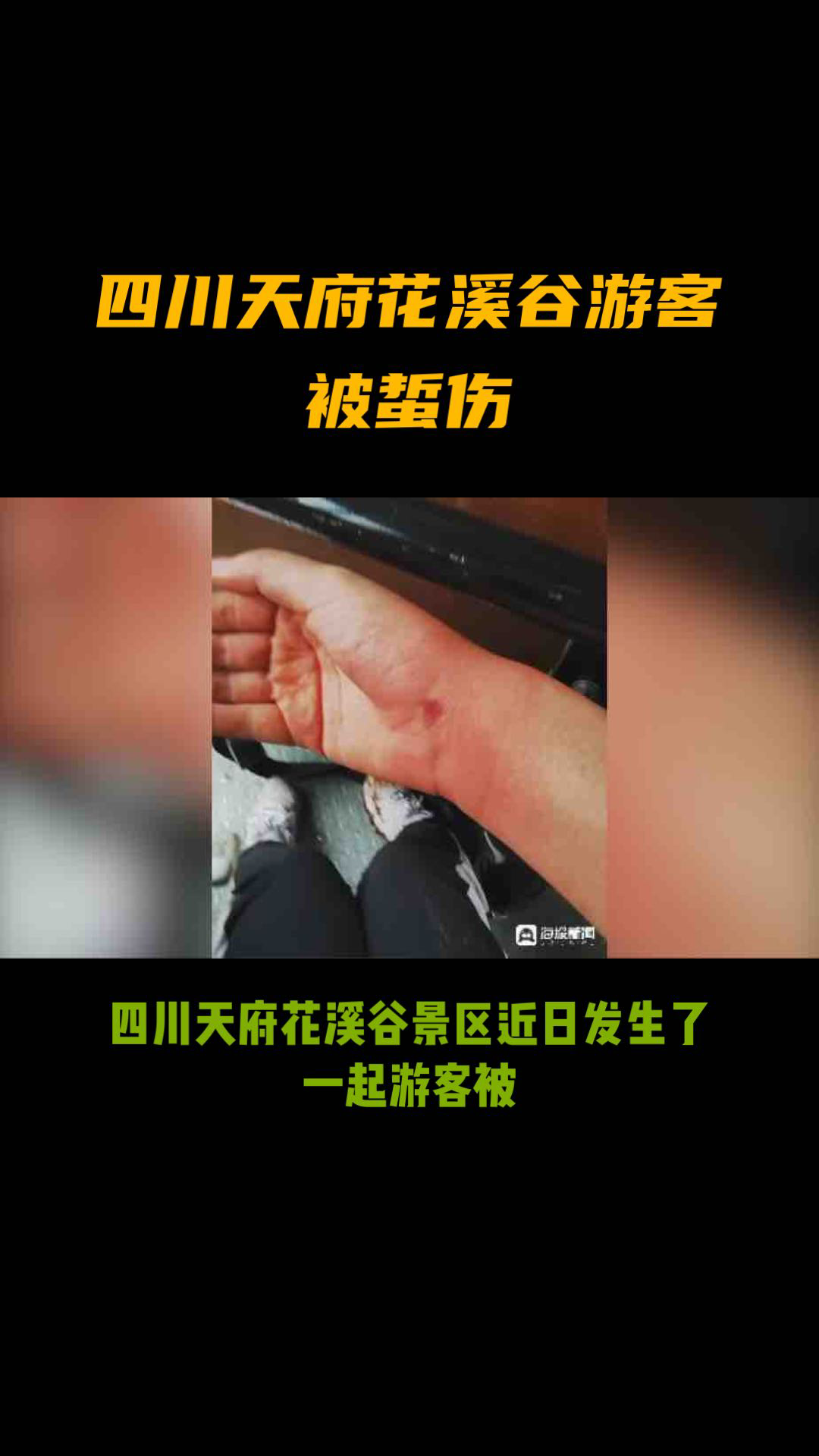 被牛角蜂蛰了怎么办图片