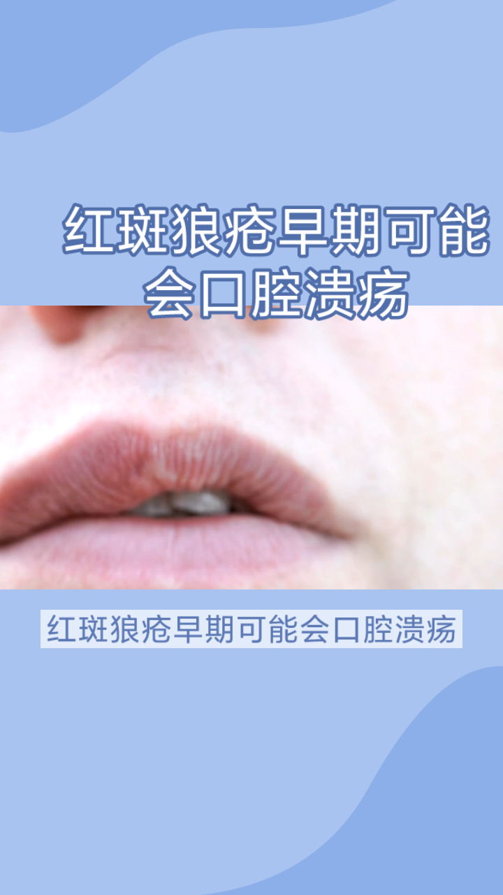 口腔红斑是什么症状图片