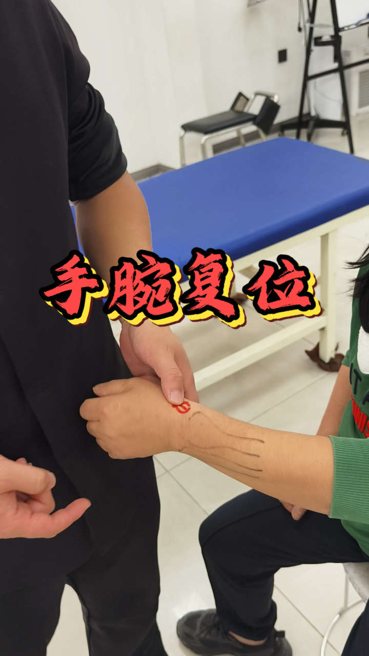 巧妙技巧:手腕复位