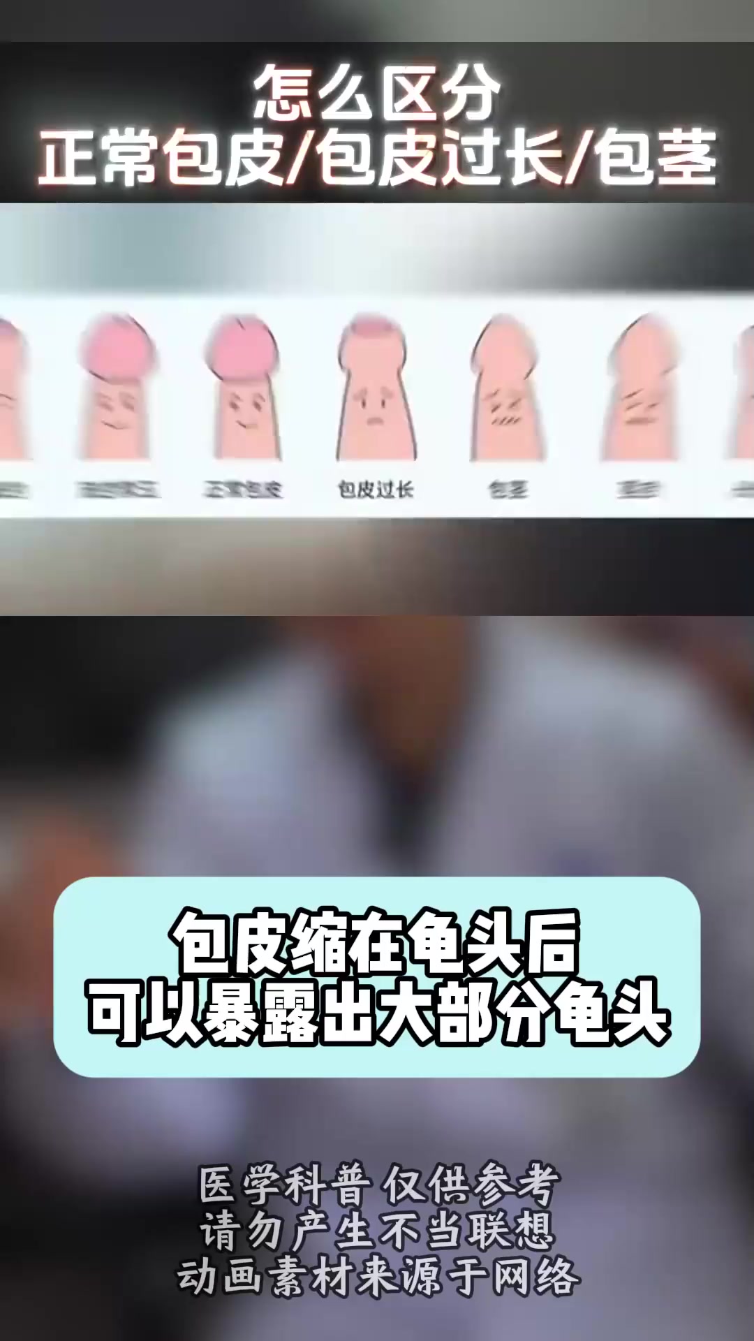 怎么区分正常包皮