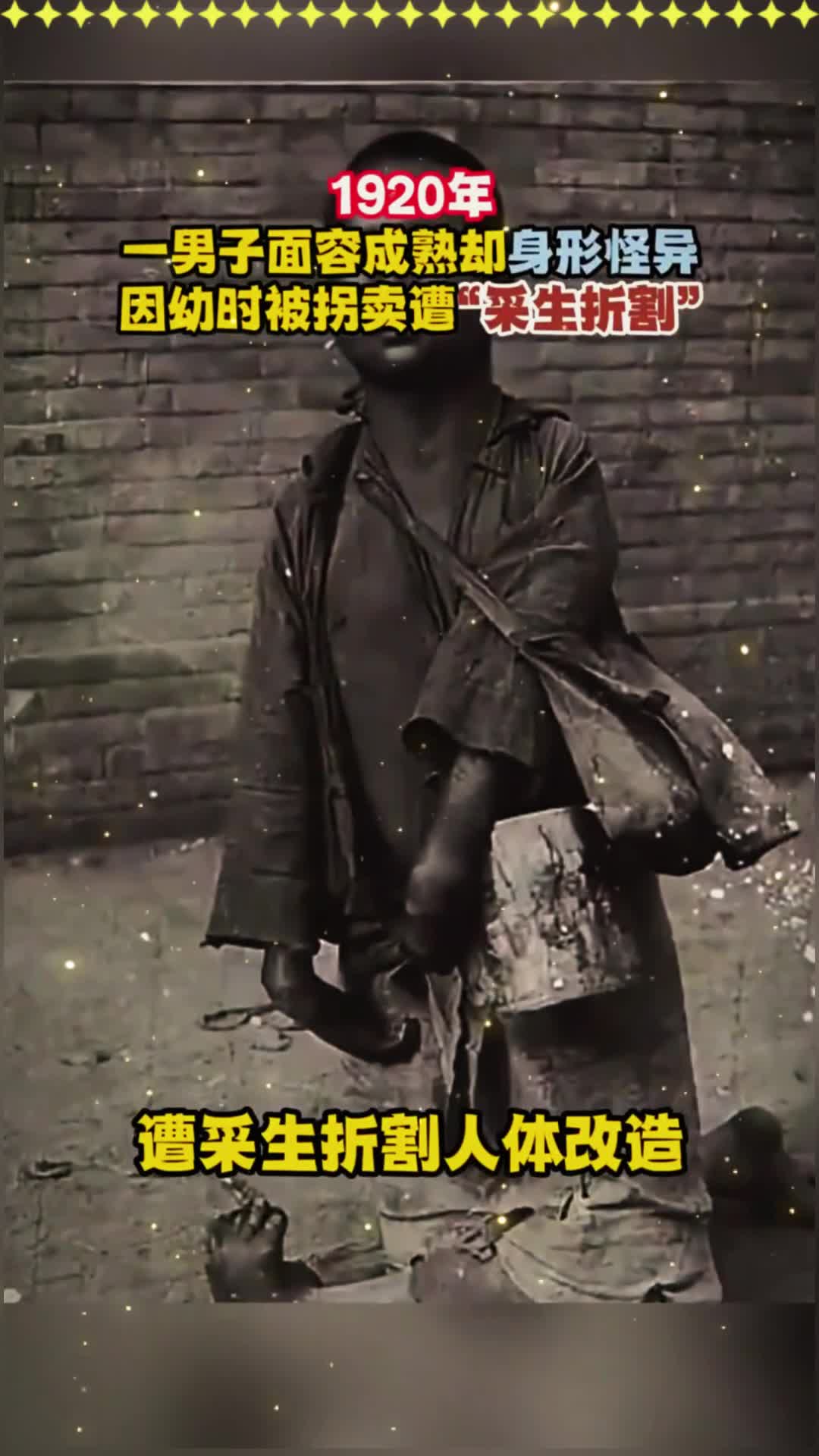 1920年,一男子面容成熟却身形怪异,因幼时被拐卖遭"采生折割"