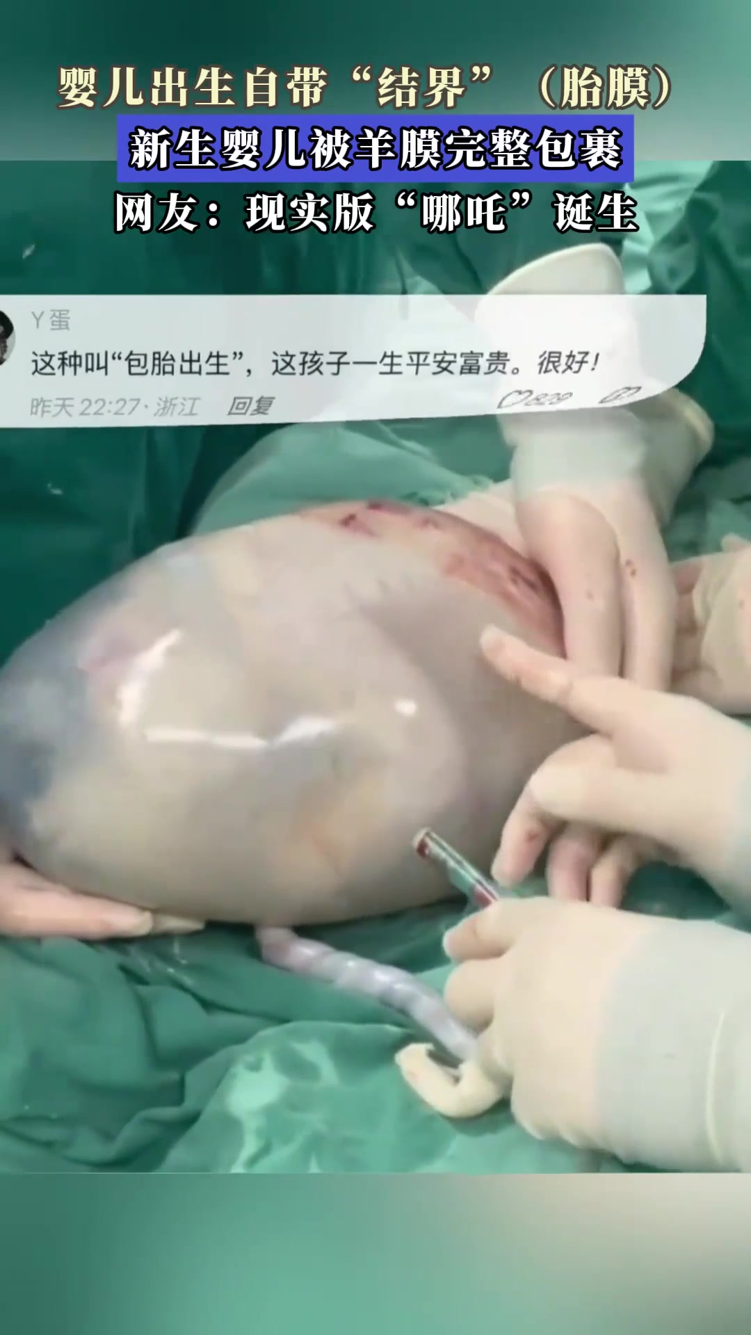 婴儿出生自带"结界"(胎膜),新生婴儿被羊膜完整包裹