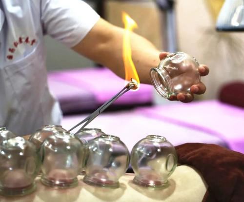 拔火罐时,吸出的瘀血就是体内的毒素?大夫说出大实话