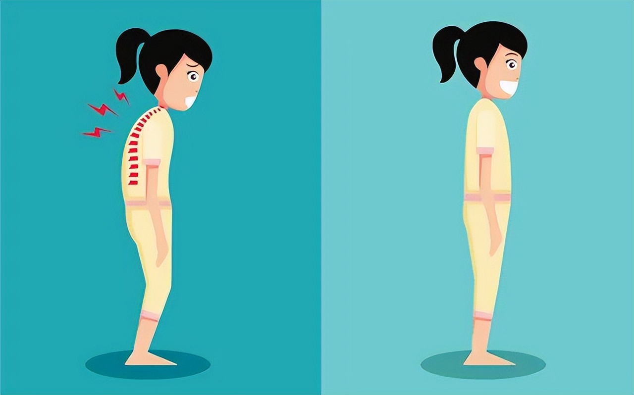 孩子常见的体态问题,家长一定要重视!别让小问题变成大毛病!