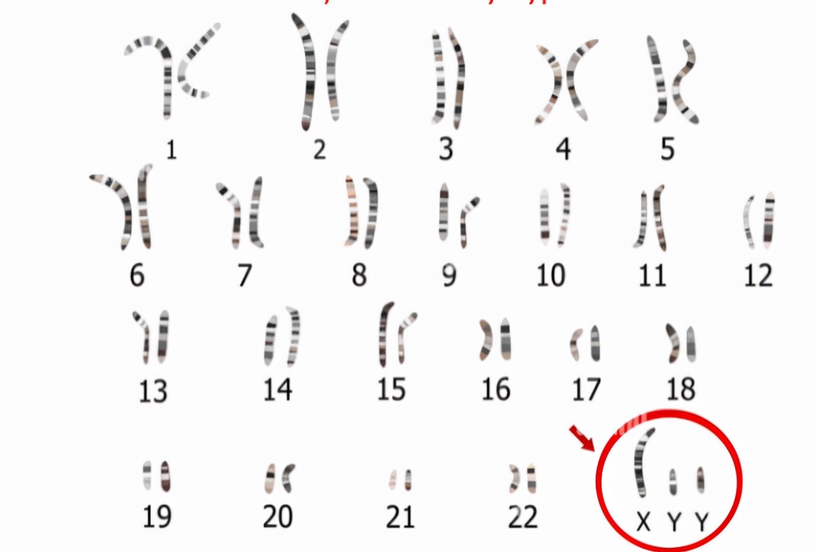 女孩染色体xy图片