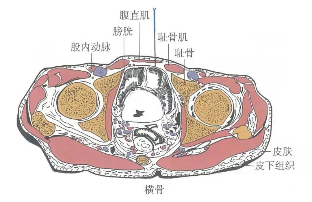 穴位知识 横骨