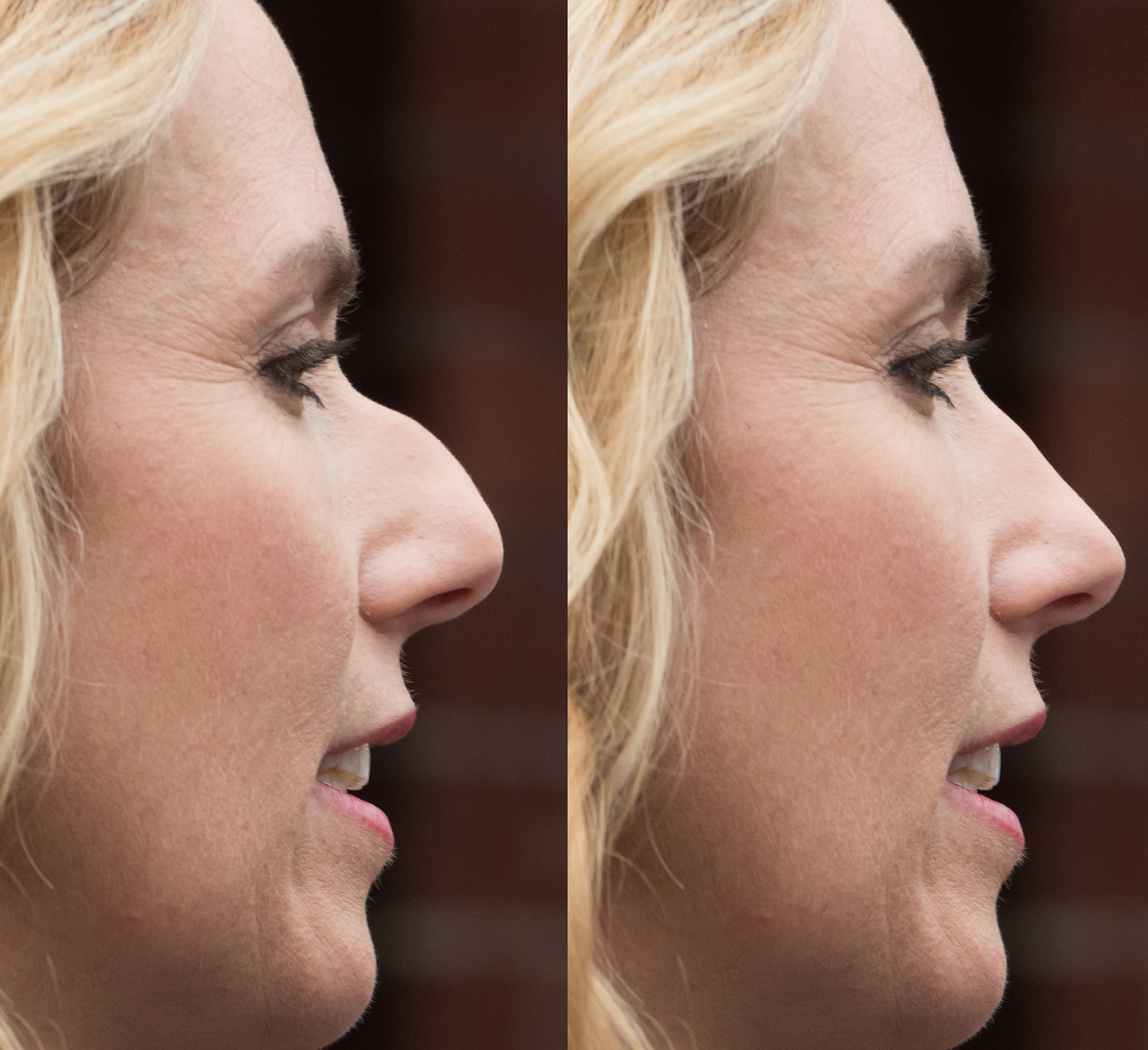 为什么不同地区人群的鼻形各异?是什么造成这种差异?