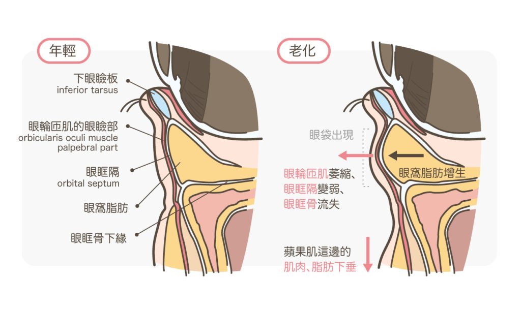 眼袋结构图并带名称图图片