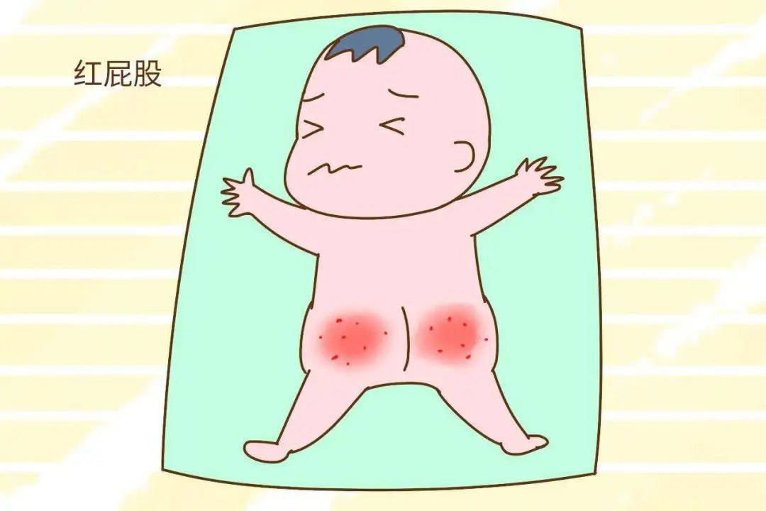 男宝宝肛周脓肿图片图片