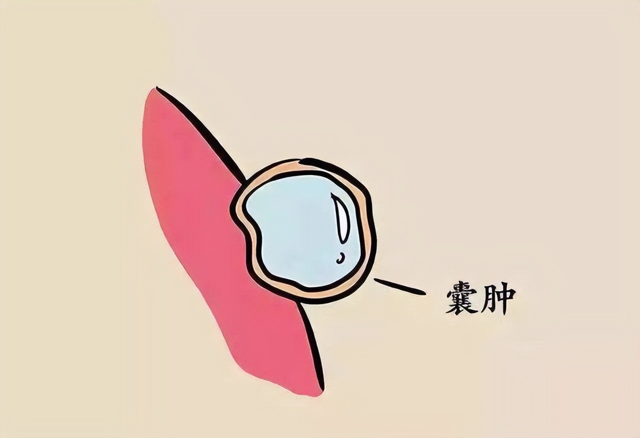 张仲景的一个神方,化瘀散结,消除肿块,专克包块,囊肿,结节